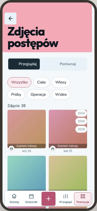 Galeria zdjęć postępów pokazuje filtry źródła i zdjęcia ułożone według dat.